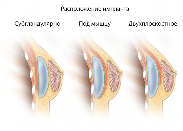 629x450