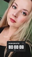 720x1280