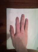 37