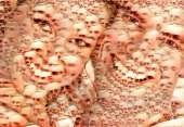 99