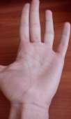 83