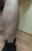 93