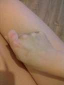 67
