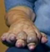 61