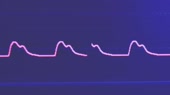 1280x720