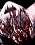 148