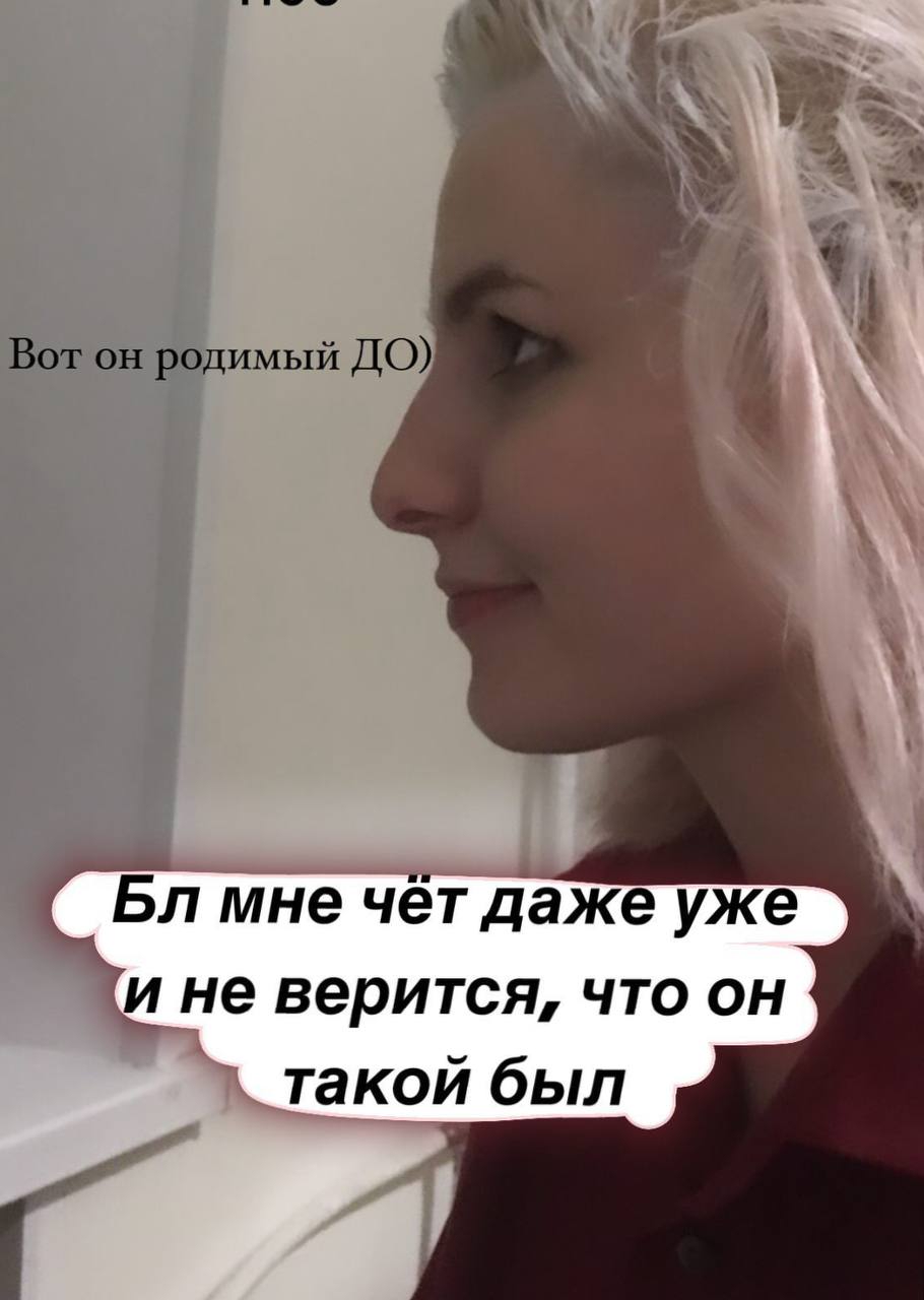 910x1280