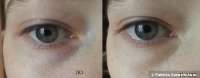 600x236