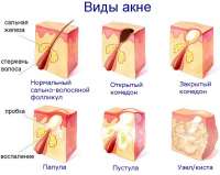 600x479