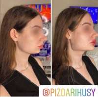 1080x1079
