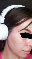 870x1600
