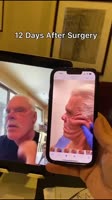 720x1280