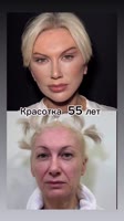 720x1280