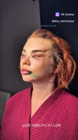 720x1280