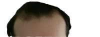 1250x464