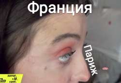 656x452