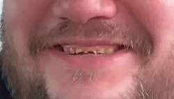 272x155
