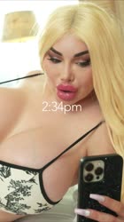 720x1280