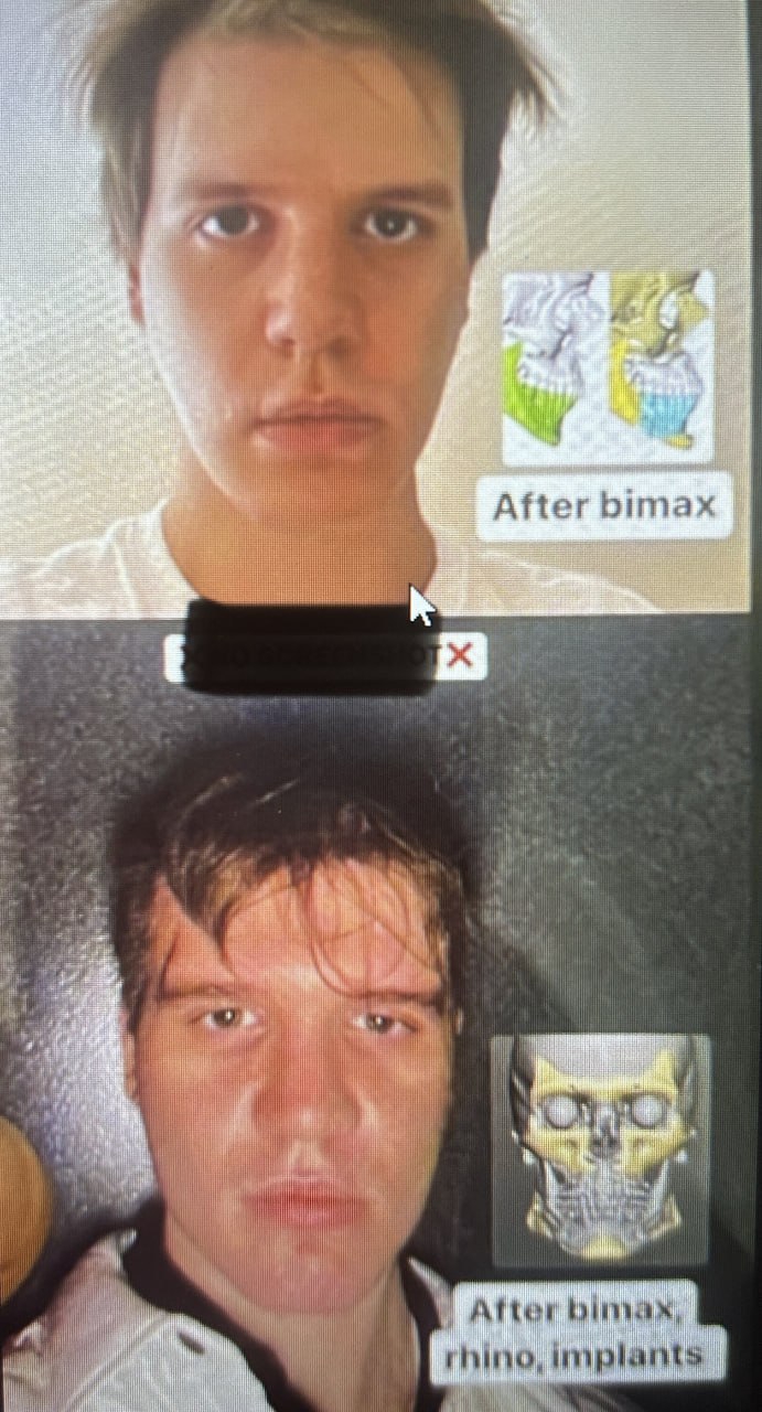 691x1280