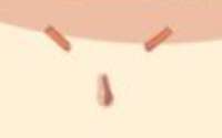 308x194