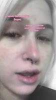720x1280