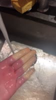 720x1280