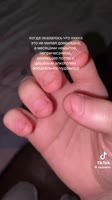 576x1024
