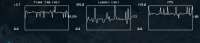 557x121