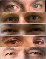 400x518