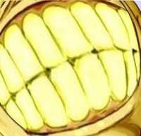 167